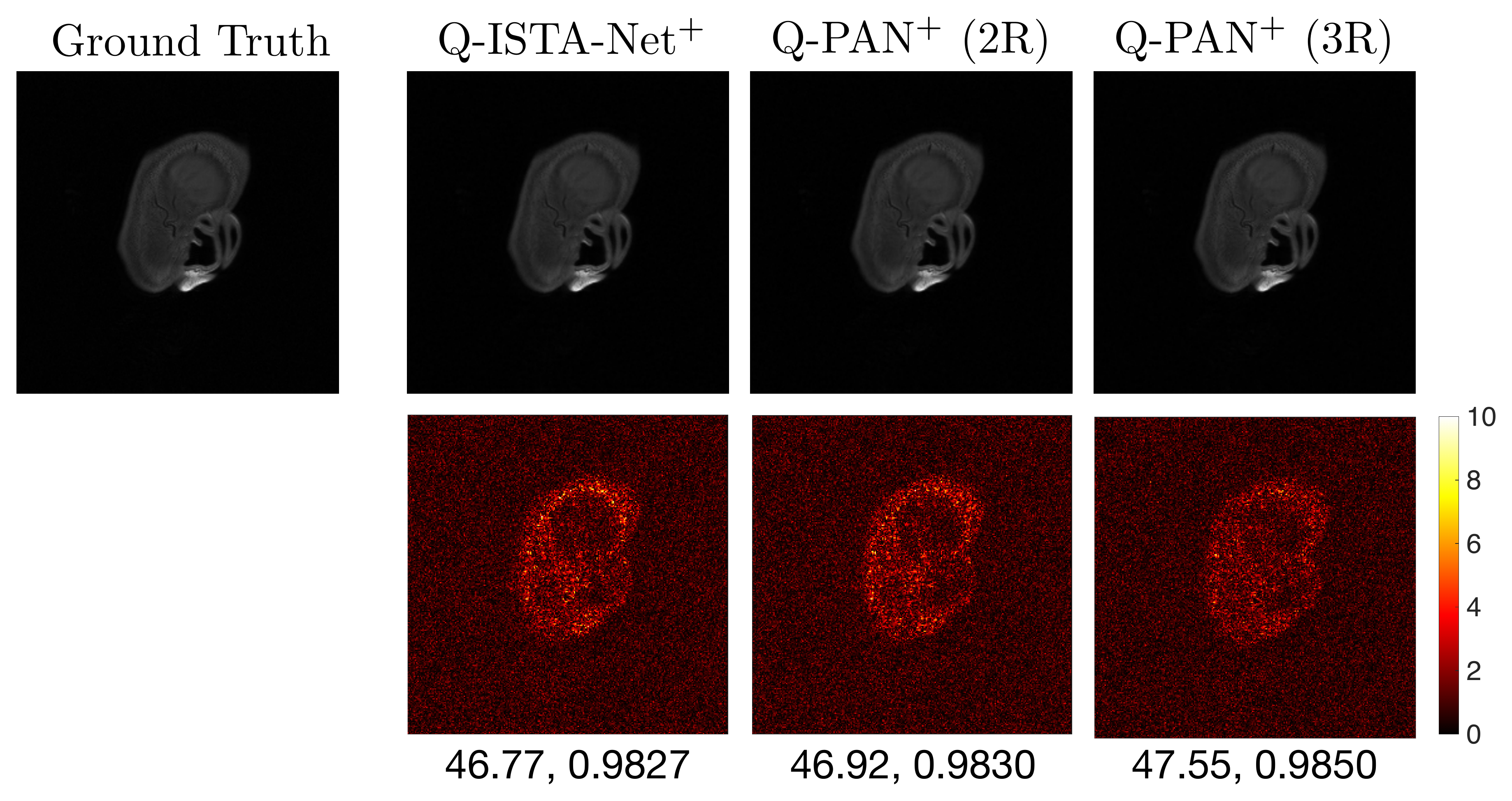 MRI reconstruction comparison: ground truth versus Q-ISTA-Net+ and Q-PAN+ (2R, 3R) with residual error maps and PSNR/SSIM scores